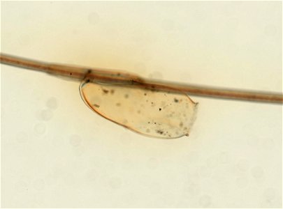 PRESERVED_SPECIMEN; ; ; microslide; ; IZ number 93606; lot count 1; Microslide 01, balsam, whole mount; egg;