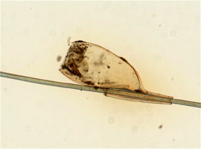 PRESERVED_SPECIMEN; ; ; microslide; ; IZ number 93610; lot count 1; Microslide 01, balsam, whole mount; egg;