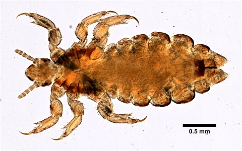 PRESERVED_SPECIMEN; FEMALE; ; microslide; ; IZ number 99314; lot count 1; Microslide 01, balsam, whole mount; female;