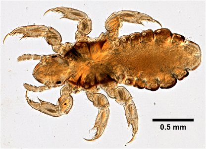 PRESERVED_SPECIMEN; ; ; microslide; ; IZ number 99315; lot count 1; Microslide 01, balsam, whole mount; young;