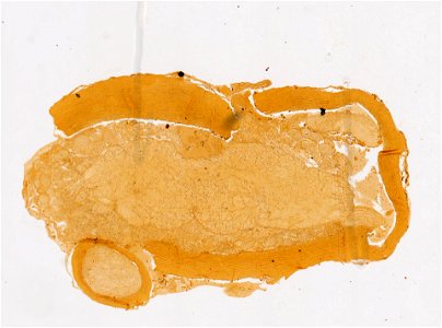 PRESERVED_SPECIMEN; ; ; microslide; ; IZ number 98229; lot count 1; Microslide 01, balsam, nerve cord, serial section; Microslide 01, balsam, ventral blood vessel, serial section; other photo