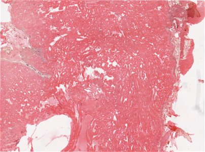 PRESERVED_SPECIMEN; ; ; microslide; ; IZ number 98230; lot count 1; Microslide 01, balsam, heart, serial section; other number 3a;