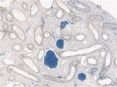 PRESERVED_SPECIMEN; ; ; microslide; ; IZ number 98234; lot count 1; Microslide 01, balsam, liver, serial section; other number 1;