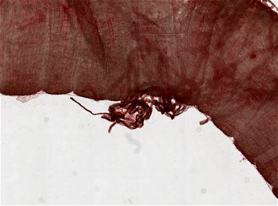 PRESERVED_SPECIMEN; ; ; microslide; ; IZ number 98662; lot count 1; Microslide 01, balsam, digestive system;