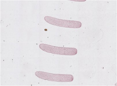 PRESERVED_SPECIMEN; MALE; ; microslide; microslide; ; IZ number 98816; lot count 1; Microslide 01, balsam, serial section; Microslide 02, balsam, serial section; Microslide 03, balsam, seria