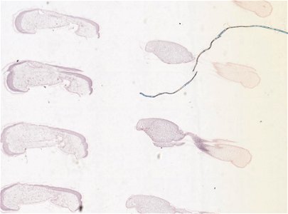 PRESERVED_SPECIMEN; MALE; ; microslide; microslide; ; IZ number 98816; lot count 1; Microslide 01, balsam, serial section; Microslide 02, balsam, serial section; Microslide 03, balsam, seria