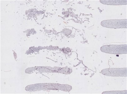 PRESERVED_SPECIMEN; MALE; ; microslide; microslide; ; IZ number 98816; lot count 1; Microslide 01, balsam, serial section; Microslide 02, balsam, serial section; Microslide 03, balsam, seria