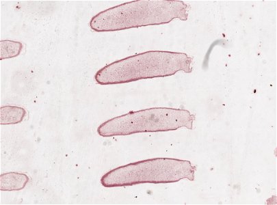 PRESERVED_SPECIMEN; MALE; ; microslide; microslide; ; IZ number 98816; lot count 1; Microslide 01, balsam, serial section; Microslide 02, balsam, serial section; Microslide 03, balsam, seria