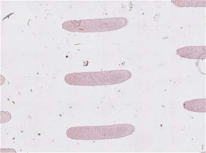 PRESERVED_SPECIMEN; MALE; ; microslide; microslide; ; IZ number 98816; lot count 1; Microslide 01, balsam, serial section; Microslide 02, balsam, serial section; Microslide 03, balsam, seria
