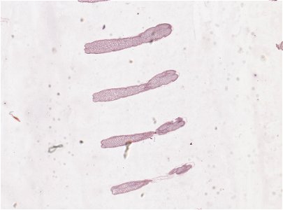 PRESERVED_SPECIMEN; MALE; ; microslide; microslide; ; IZ number 98816; lot count 1; Microslide 01, balsam, serial section; Microslide 02, balsam, serial section; Microslide 03, balsam, seria