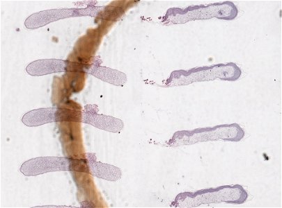 PRESERVED_SPECIMEN; MALE; ; microslide; microslide; ; IZ number 98816; lot count 1; Microslide 01, balsam, serial section; Microslide 02, balsam, serial section; Microslide 03, balsam, seria