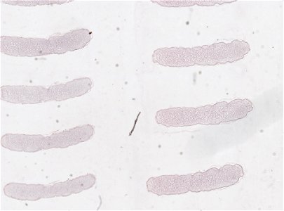 PRESERVED_SPECIMEN; ; ; microslide; ; IZ number 98819; lot count 1; Microslide 01, balsam, serial section; egg;