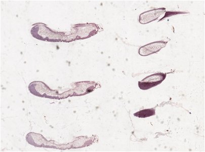 PRESERVED_SPECIMEN; ; ; microslide; ; IZ number 98820; lot count 1; Microslide 01, balsam, serial section; egg;