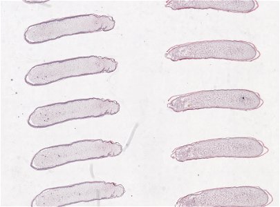 PRESERVED_SPECIMEN; ; ; microslide; ; IZ number 98822; lot count 1; Microslide 01, balsam, serial section; egg;