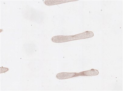 PRESERVED_SPECIMEN; ; ; microslide; ; IZ number 98831; lot count 1; Microslide 01, balsam, serial section; egg;