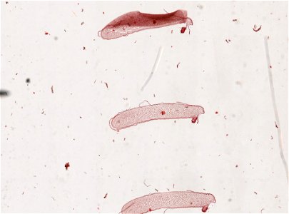 PRESERVED_SPECIMEN; FEMALE; ; microslide; ; IZ number 98836; lot count 1; Microslide 01, balsam, serial section; female;