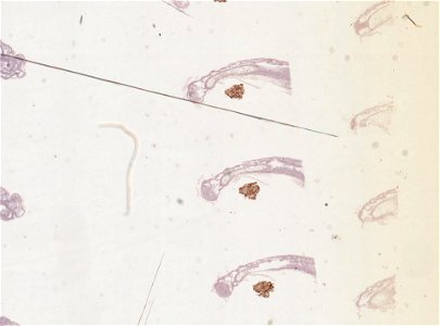 PRESERVED_SPECIMEN; FEMALE; ; microslide; ; IZ number 98838; lot count 1; Microslide 01, balsam, serial section; female;
