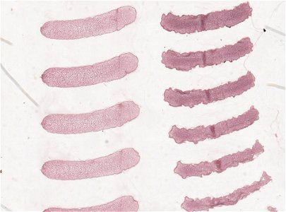 PRESERVED_SPECIMEN; MALE; ; microslide; ; IZ number 98843; lot count 1; Microslide 01, balsam, serial section; male;