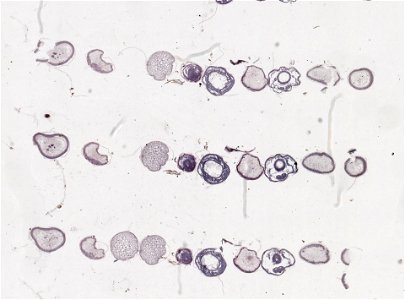 PRESERVED_SPECIMEN; ; ; microslide; ; IZ number 98847; lot count 1; Microslide 01, balsam, serial section;