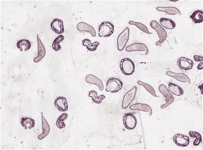 PRESERVED_SPECIMEN; ; ; microslide; ; IZ number 98848; lot count 1; Microslide 01, balsam, serial section;