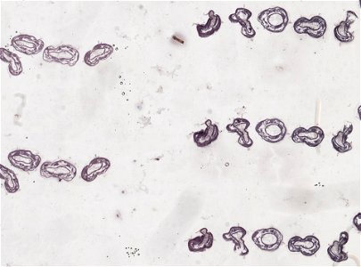 PRESERVED_SPECIMEN; ; ; microslide; ; IZ number 98849; lot count 1; Microslide 01, balsam, serial section;
