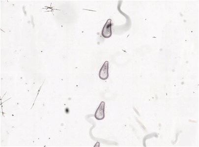 PRESERVED_SPECIMEN; ; ; microslide; ; IZ number 98853; lot count 1; Microslide 01, balsam, serial section;