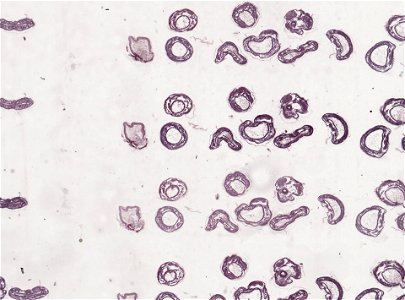 PRESERVED_SPECIMEN; ; ; microslide; ; IZ number 98854; lot count 1; Microslide 01, balsam, serial section;