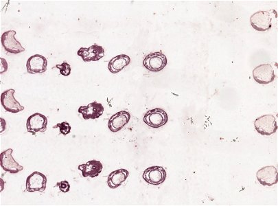 PRESERVED_SPECIMEN; ; ; microslide; ; IZ number 98857; lot count 1; Microslide 01, balsam, serial section;