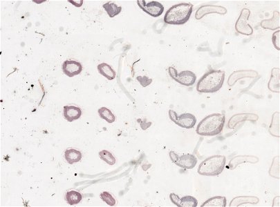 PRESERVED_SPECIMEN; ; ; microslide; ; IZ number 98859; lot count 1; Microslide 01, balsam, serial section;