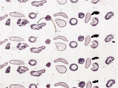 PRESERVED_SPECIMEN; ; ; microslide; ; IZ number 98860; lot count 1; Microslide 01, balsam, serial section;