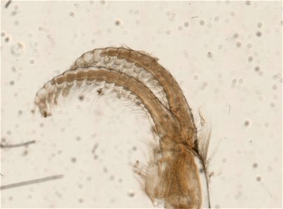 PRESERVED_SPECIMEN; ; ; microslide; ; Gray Museum; IZ number 73648; lot count 1; Microslide 01, cirri; original catalog number GM 5349; 1962-09-13T00:00:00Z
