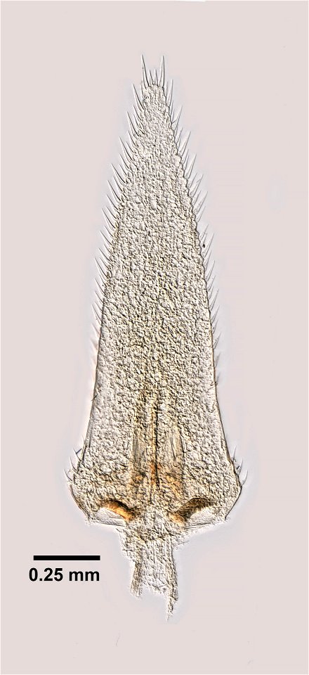 PRESERVED_SPECIMEN; ; ; 70% alc.; microslide; Det. by: Thomas E. Bowman; GM image; Gray Museum; IZ number 83136; lot count 1; original catalog number GM 1104; 1957-04-28T00:00:00Z