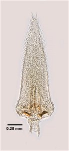 PRESERVED_SPECIMEN; ; ; 70% alc.; microslide; Det. by: Thomas E. Bowman; GM image; Gray Museum; IZ number 83136; lot count 1; original catalog number GM 1104; 1957-04-28T00:00:00Z