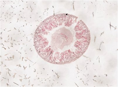 PRESERVED_SPECIMEN; ; ; microslide; ; IZ number 98186; lot count 1; Microslide 01, balsam, intestines, serial section;