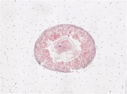 PRESERVED_SPECIMEN; ; ; microslide; ; IZ number 98194; lot count 1; Microslide 01, balsam, intestines, serial section;