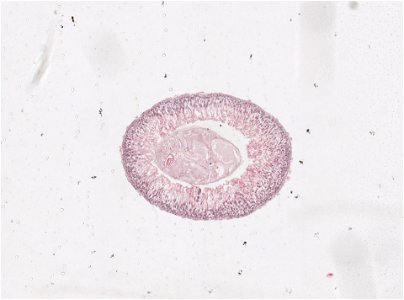 PRESERVED_SPECIMEN; ; ; microslide; ; IZ number 98195; lot count 1; Microslide 01, balsam, intestines, serial section;