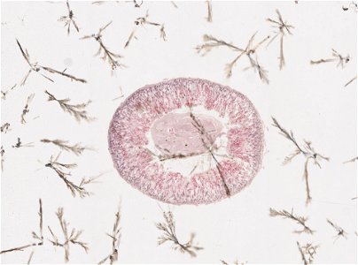 PRESERVED_SPECIMEN; ; ; microslide; ; IZ number 98198; lot count 1; Microslide 01, balsam, intestines, serial section;