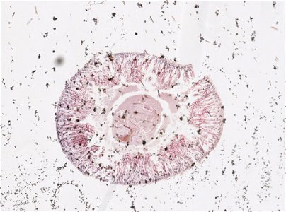 PRESERVED_SPECIMEN; ; ; microslide; ; IZ number 98199; lot count 1; Microslide 01, balsam, intestines, serial section;