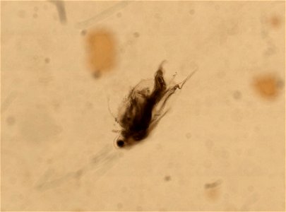 PRESERVED_SPECIMEN; ; ; microslide; HYPOTYPE. See: Brooks, John L. 1957. The systematics of North American Daphnia. Memoirs of the Connecticut Academy of Arts and Sciences. 13: 1-180.; IZ nu