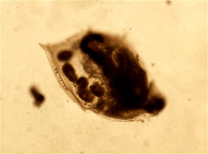 PRESERVED_SPECIMEN; ; ; microslide; HYPOTYPE. See: Brooks, John L. 1957. The systematics of North American Daphnia. Memoirs of the Connecticut Academy of Arts and Sciences. 13: 1-180.; IZ nu photo