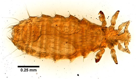 PRESERVED_SPECIMEN; ; ; microslide; ; IZ number 99336; lot count 1; Microslide 01, balsam, whole mount; photo