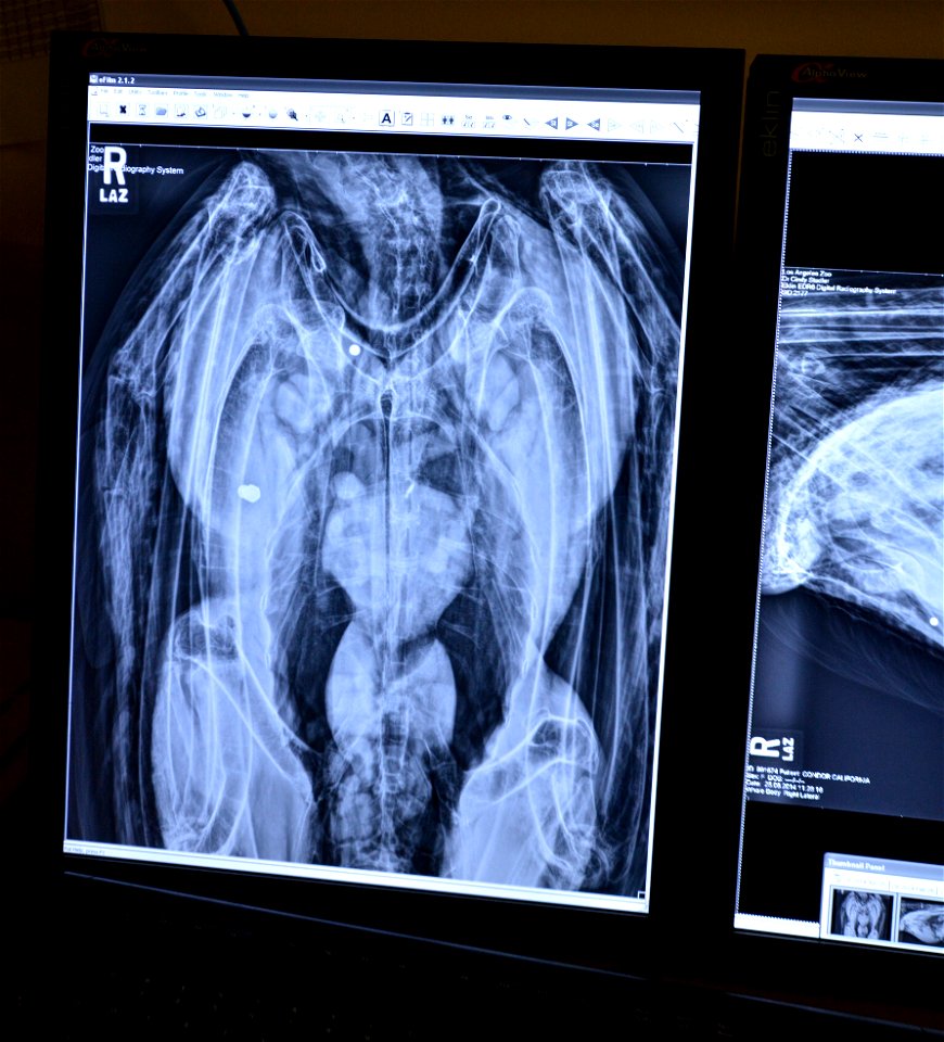 An apparent shotgun pellet is shown just left of Condor #42's breast bone.  The Hexagon shape below left is the nut and bolt that affixes the condor tag.  Photo: Jon Myatt/USFWS
