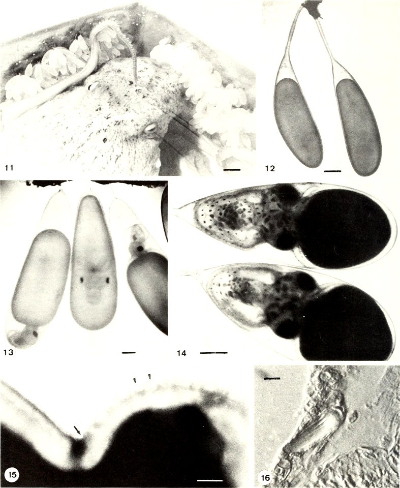 : American malacological bulletin
Identifier: americanmal4519861987amer (find matches)
Year: 1983 (1980s)
Authors: American Malacological Union
Subjects: Mollusks; Mollusks
Publisher: (Hattiesburg, Mi
