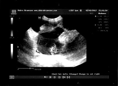 Ultrasonography of the uterine pregnancy of a European roe deer (Capreolus Capreolus). photo