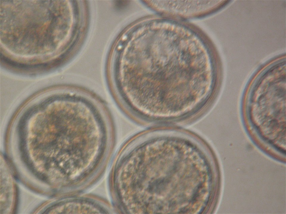 March 18, 2011 - Black Creek (Rapides Parish)
Another awesome pic! These are fertilized LA pearlshell embroys!
Photographer:  Tony Brady, mussel propogation biologist

www.fws.gov/natchitoches/
