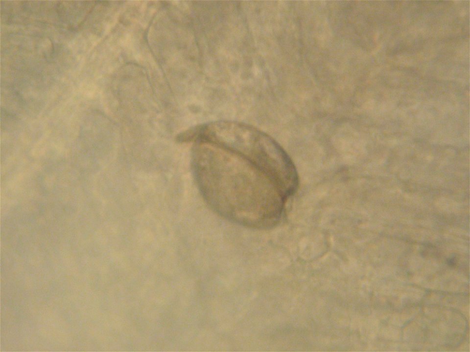 March 24, 2011 - Natchitoches National Fish Hatchery
Close up pic of Louisiana pearlshell mussel glochidia. 
Photographer:  Tony Brady, mussel propogation biologist

www.fws.gov/natchitoches/