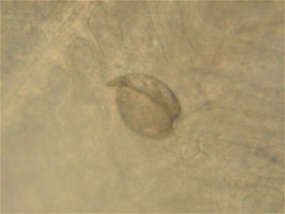 March 24, 2011 - Natchitoches National Fish Hatchery
Close up pic of Louisiana pearlshell mussel glochidia. 
Photographer:  Tony Brady, mussel propogation biologist

www.fws.gov/natchitoches/