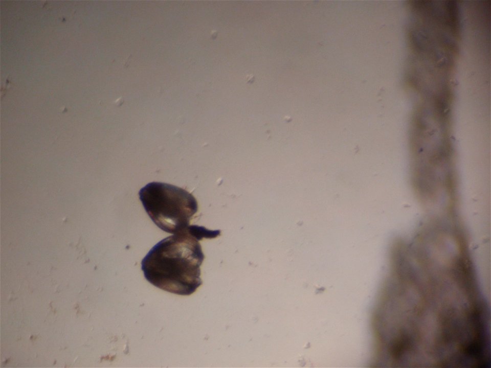 January 15, 2011 - Natchitoches, LA
These are two baby Little Spectaclecase mussels under the microscope. They were also just harvested from their host fish earlier that morning. 
Photographer:  Tony 