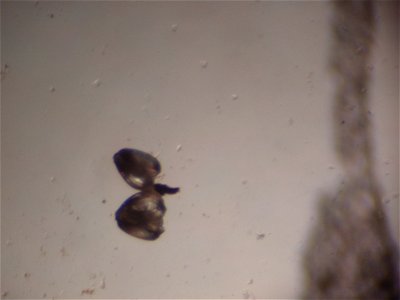 January 15, 2011 - Natchitoches, LA
These are two baby Little Spectaclecase mussels under the microscope. They were also just harvested from their host fish earlier that morning. 
Photographer:  Tony 