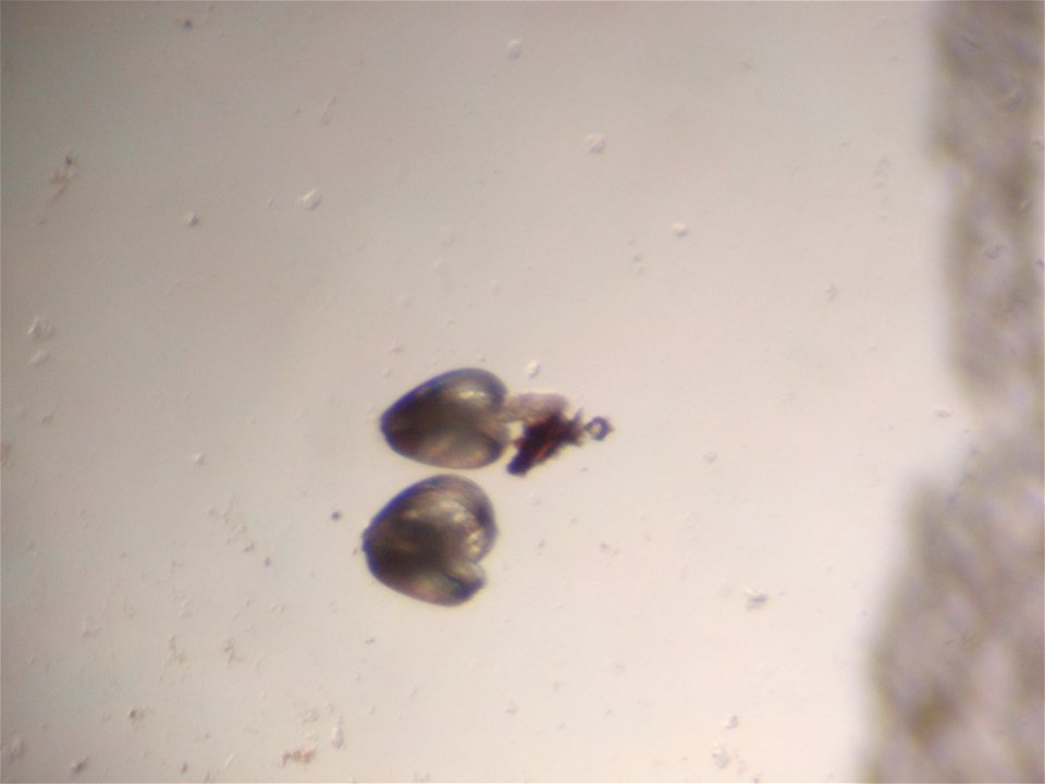 January 15, 2011 - Natchitoches, LA
These are two baby Little Spectaclecase mussels under the microscope. They were also just harvested from their host fish earlier that morning. 
Photographer:  Tony 